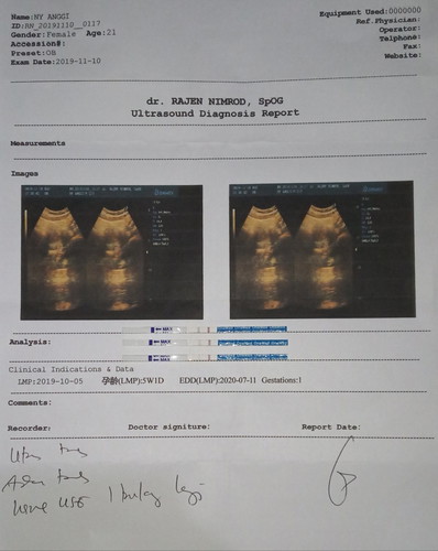 Alhamdulillah. Kuasa Allah SWT Maha Besar