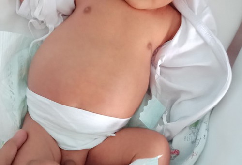 Tummy ni baby