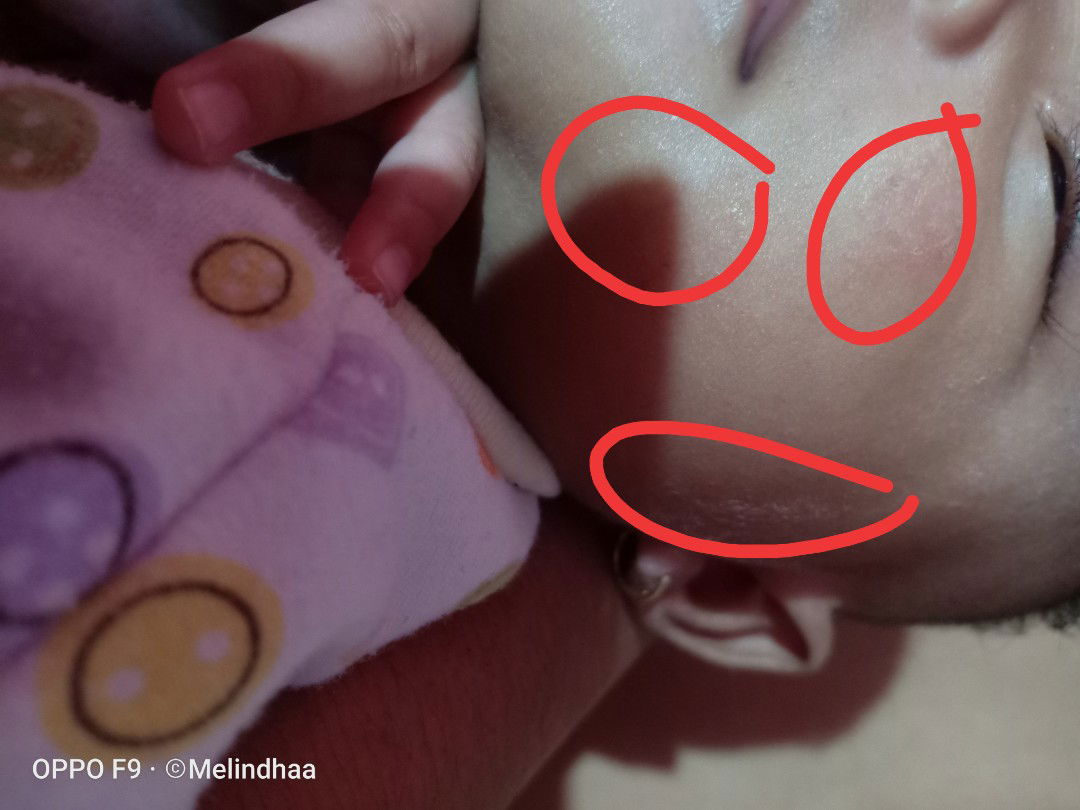 Rekom cream atau bedak