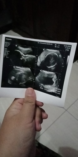 29weeks4day