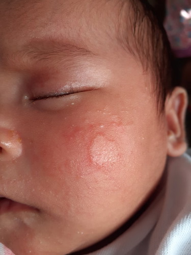 Ringworm? Rashes?