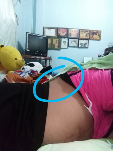 ลูกดิ้นตรงเอว