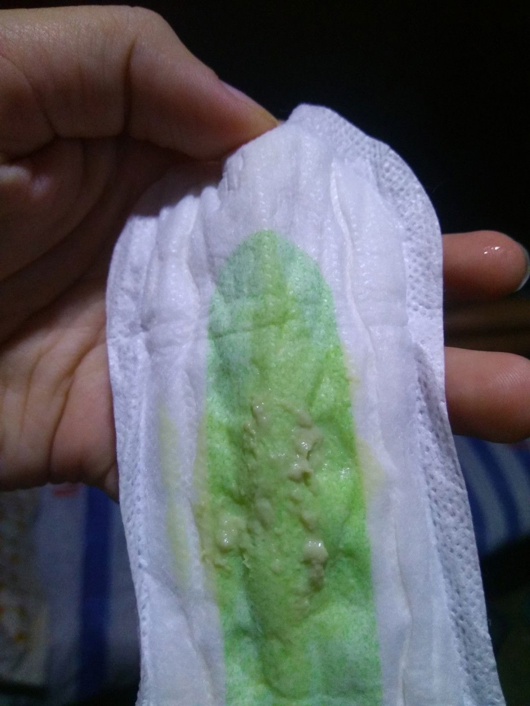 White Discharge or Mucus Plug?