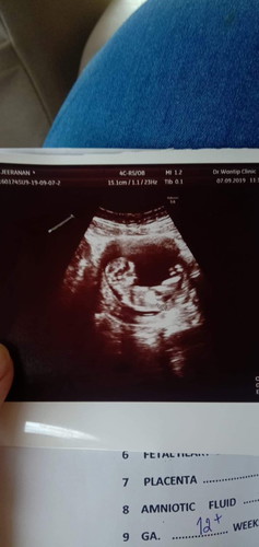 ผู้ชายปล่าวน้าา?