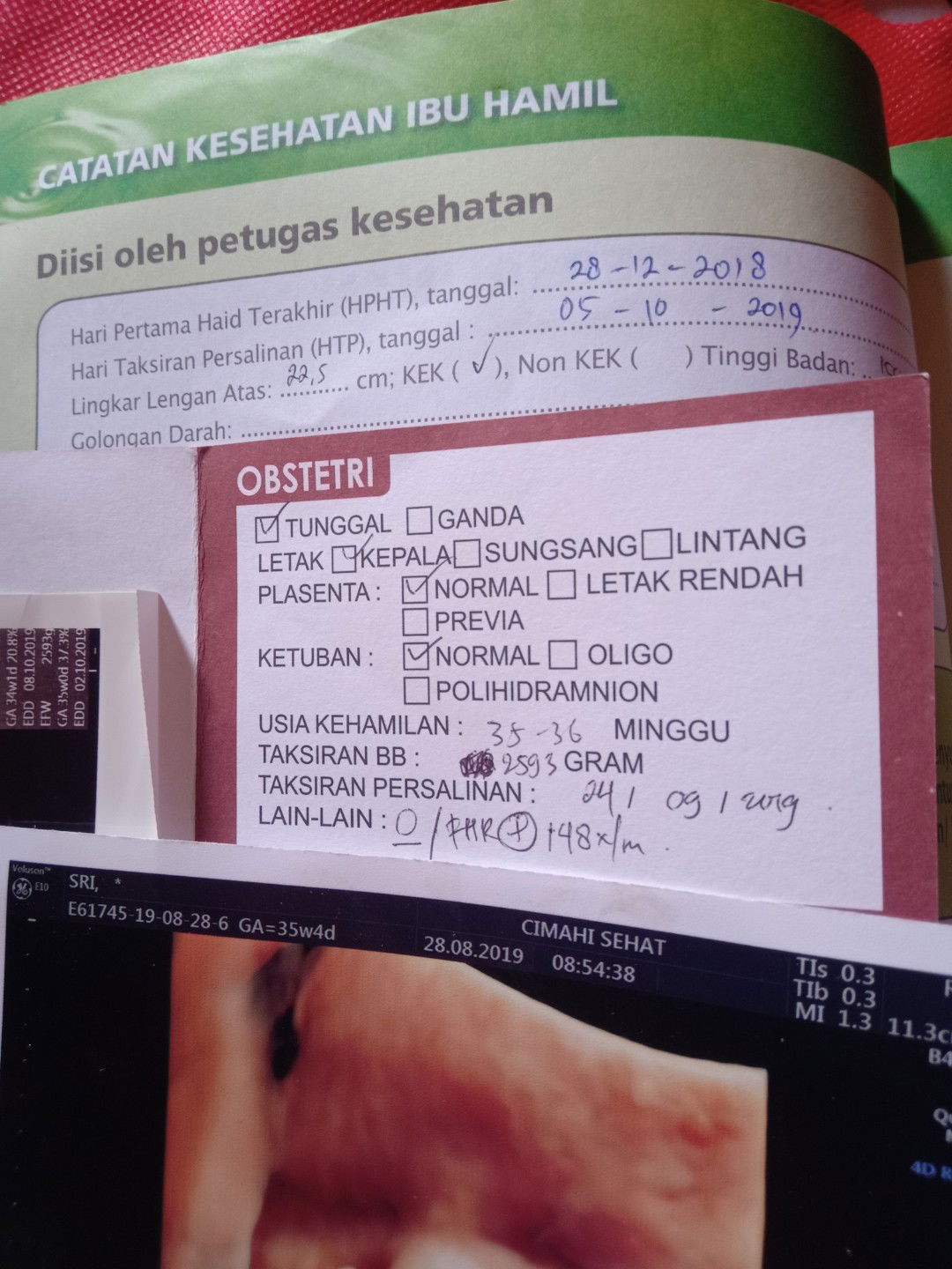 Hasil usg atau perhitungan bidan?