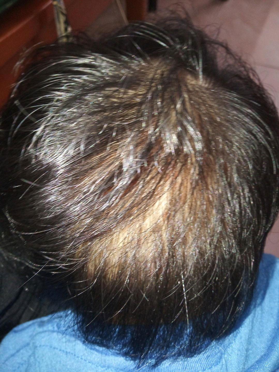 kulit kepala anak merah