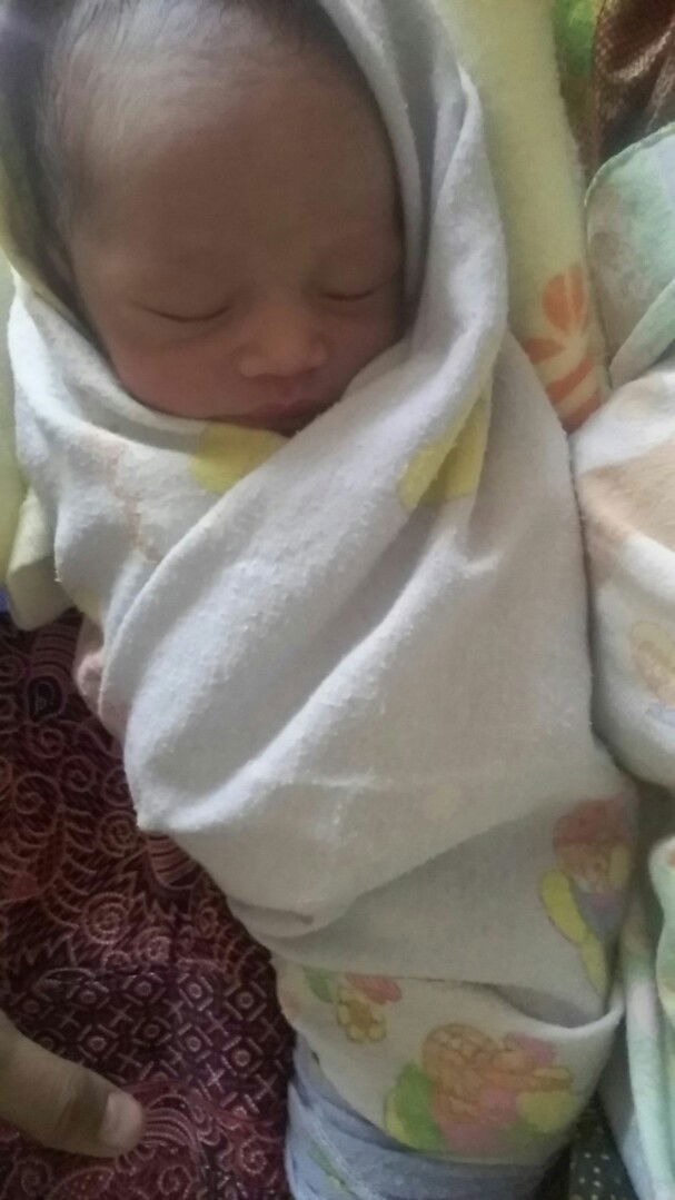 lilit tali pusat 2x lahiran normal