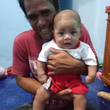 jari tangan tdk buka lebar