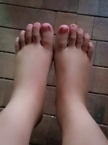 kaki bengkak memasuki 37w