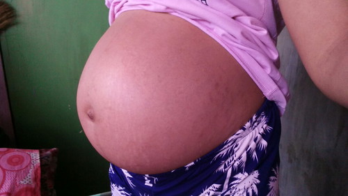 pregnancy