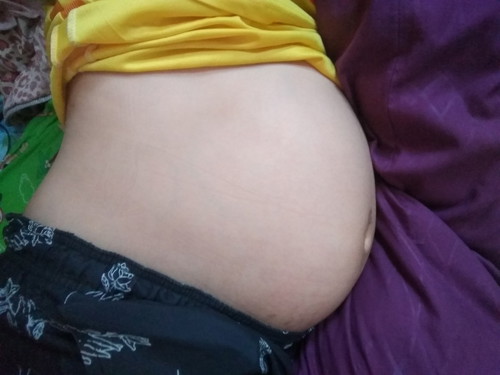 เจ็บเตือนค่ะ!!