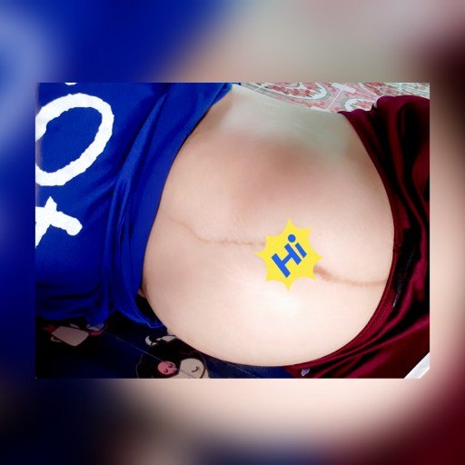 Post reply image