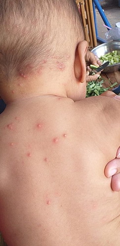 เครียดมากเรยค่ะ