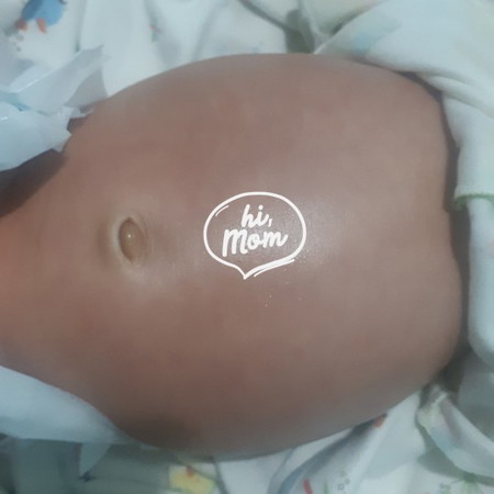 bayi 25 hari perut nya besar ga bun?