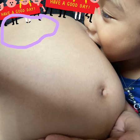 ปวดบริเวณนี้