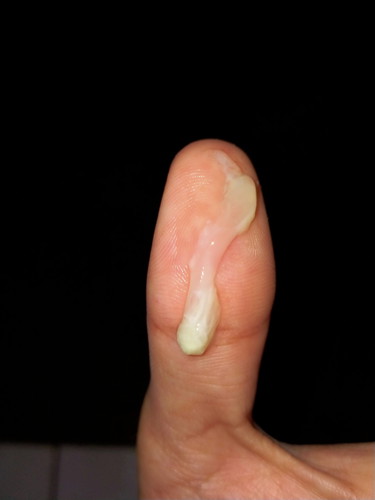 แบบนี้ตกขาวหรือมูกใสค่ะ