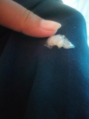 ตกขาวหรือมูกสีใสๆ