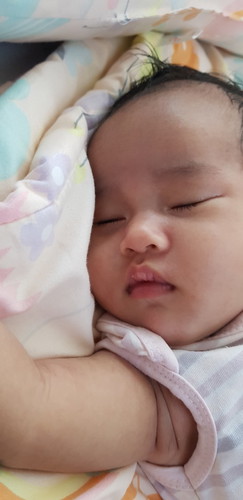 normal lang ba na medyo maitim ang kili kili ng baby?