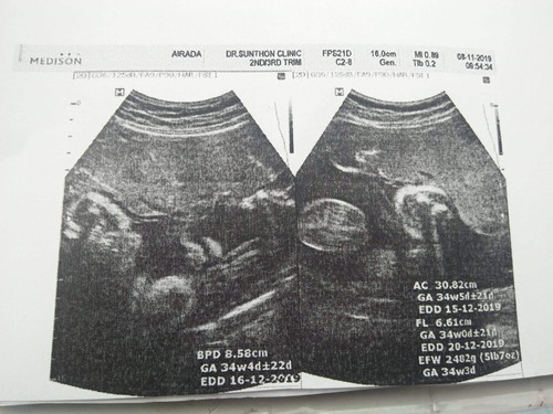 น้ำหนักลูก