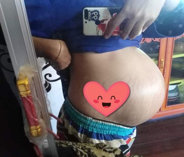 เหมือนลูกโป่งเลย(เอาไม้มาจิ้มจะแตกไหม555)