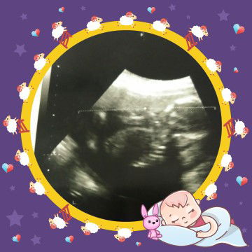 scan 18w ikut calendar 19w