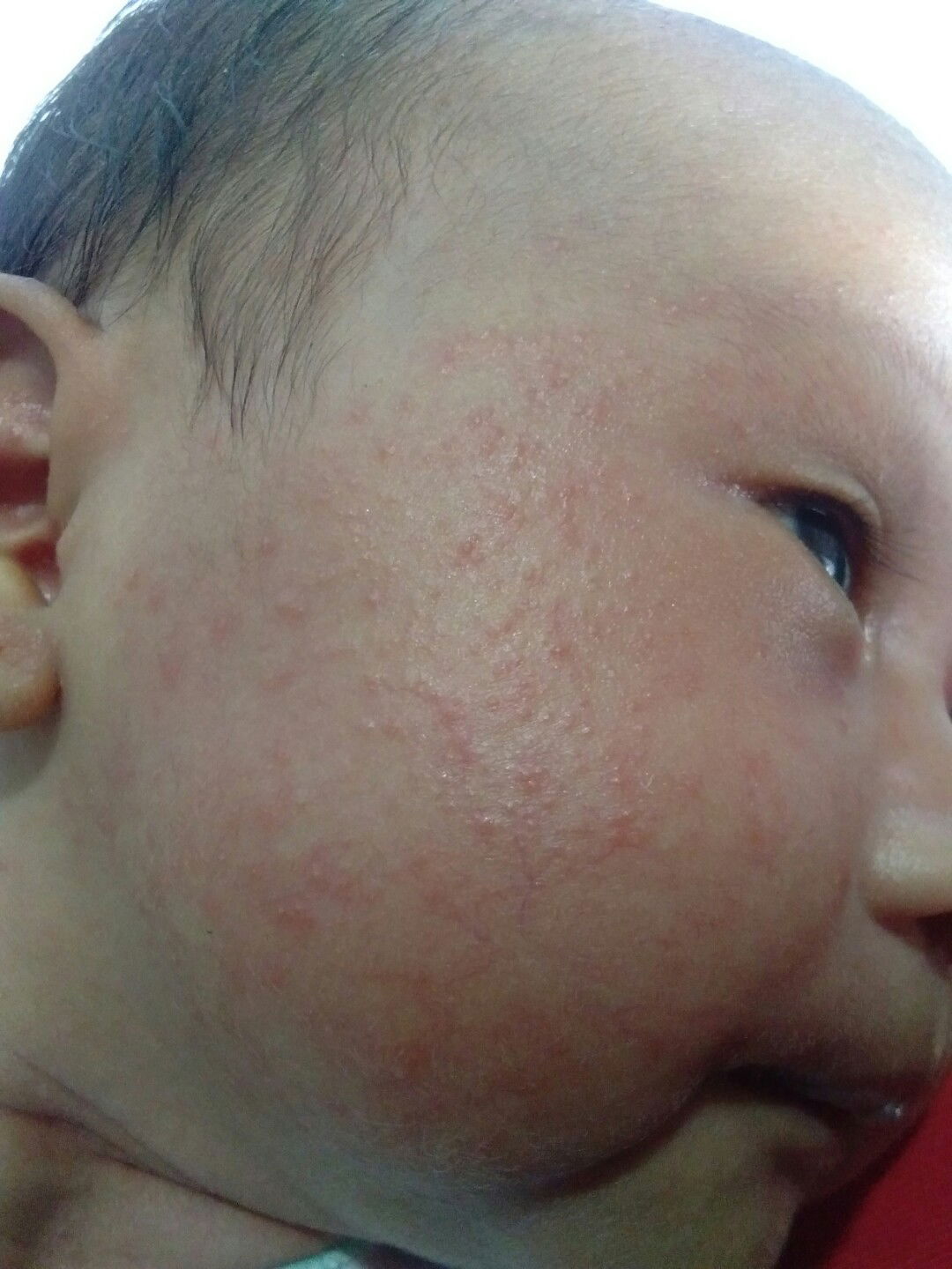 Gara2 susu / keringat?