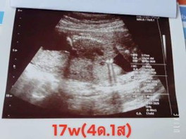 17wยังไม่เห็นเพศหนูเลย..หนูขี้อายรึป่าว???