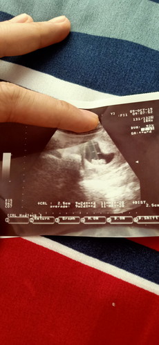 สอบถามคะ