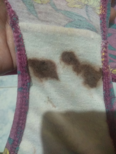 spotting o discharge?