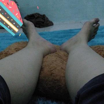 kaki bengkak