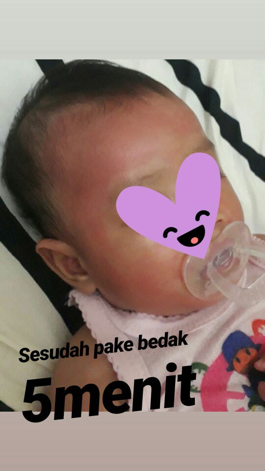 muka bayi merah