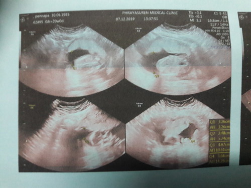 24week