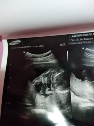 ไปหาหาหมอเมื่อวันพุธหมอบอกน่าจะเพศ ญ เพื่อนๆดูออกไหมว่าเปนเพศญจริงไหม