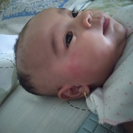 merah di pipi