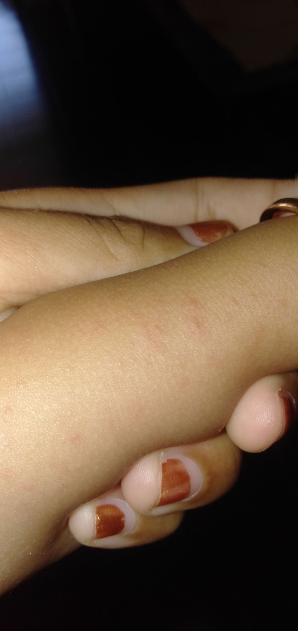 keluar kemerahan di badan