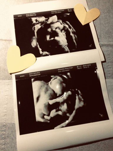 Nunu Nyun profile icon