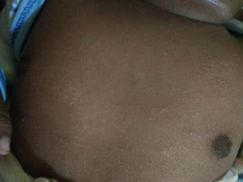 kulit bayi