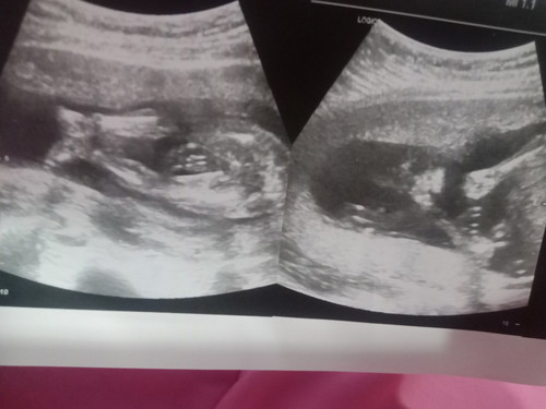 ผู้หญิงจะดีใจมากค่ะ