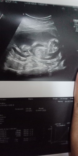 4เดือนแล้ว
