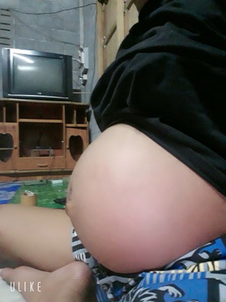 เดือนหน้าก็คลอดเเล้วท้องเล็กไปไหมคะ