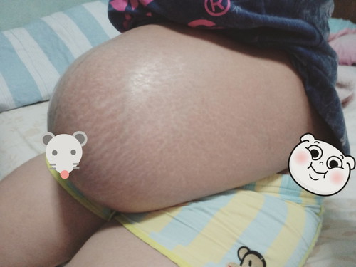 ปวดเจ็บเตือน