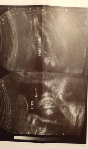 Ano Po sa tingin nyo mga momsh?