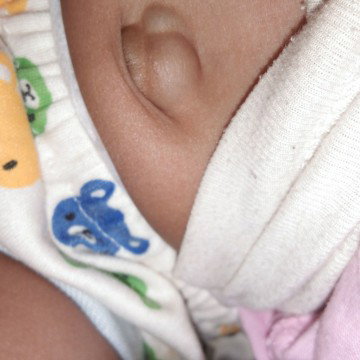 mintak solusi dong buibu