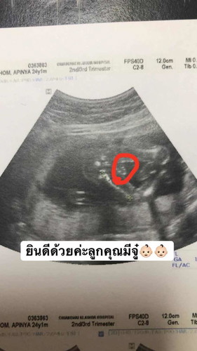 ผู้ชายมั้ยคะ