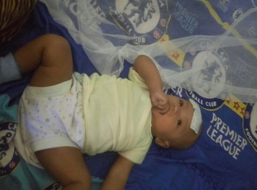 demam