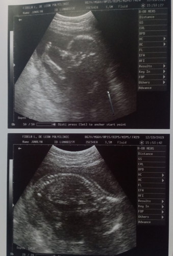gender ni baby?