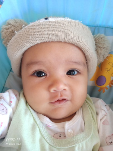 อาหารสำหรับเดฺกแพ้นมวัว