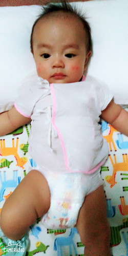 อาการสงสััย