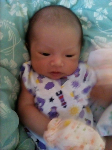 หัวล้าน