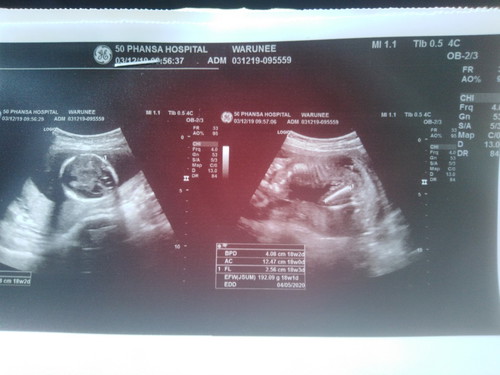 ชายหรือหญิงค่ะเเม่ๆ